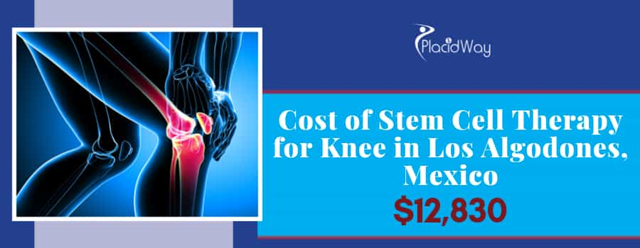 Stem Cell Therapy for Knees in Mexico